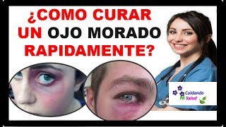 💡 COMO CURAR UN OJO MORADO  3 pasos para tratar y eliminar Moretones o Hematoma facial 2021 ✅ [upl. by Cressy]