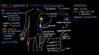 Thrombocytosis Hemostasis  Lesson 9 [upl. by Ecirtnom]