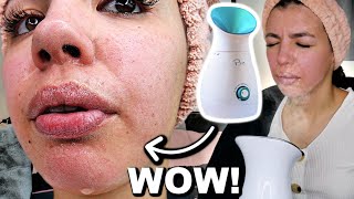 I Tested The Best FACIAL STEAMER On Amazon [upl. by Krystal]