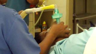 General Anesthesia Induction Routine [upl. by Frodi]