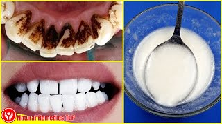 No Need For A Dentists Advice Remove Plaque And Tartar With Only These 3 Ingredients [upl. by Tonya598]