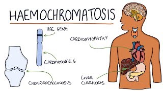 Understanding Haemochromatosis [upl. by Irdua]