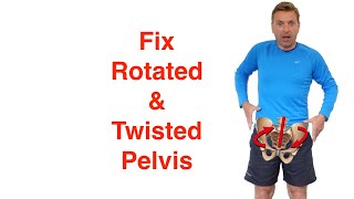 Best Rotated Pelvis Correction Exercises [upl. by Shoifet980]