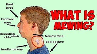 What is MEWING How To Mew And How It Can Change Your Face [upl. by Atsugua]