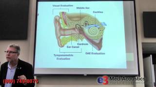 Auditory Evoked Potentials  OtoAcoustic Emissions OAE [upl. by Ugo]