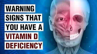 14 Signs Of Vitamin D Deficiency [upl. by Oidacra491]