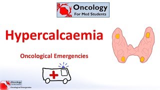 Hypercalcaemia of malignancy [upl. by Georas104]