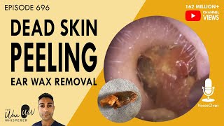 How to TREAT A PEELING TATTOO  Tips Tricks amp Healing Experience [upl. by Annet]