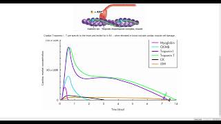 Troponin and MI [upl. by Wind]