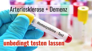 Demenz und Arterienverkalkung  Gefahr durch Homocystein [upl. by Vanna]