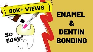 Enamel and Dentin Bonding Simplified [upl. by Schwarz965]