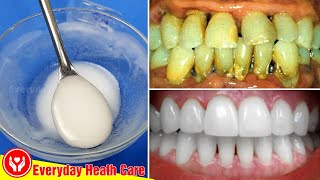 Use Only This Toothpaste  Remove Tartar And Whiten Teeth Quickly [upl. by Asit693]