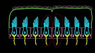 Liberatory Maneuver for Left Posterior Canalithiasis [upl. by Vic]