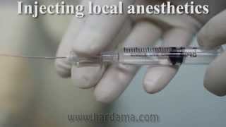 History Of Anaesthesia [upl. by Ayanahs]