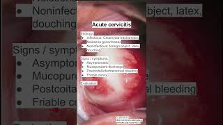 Acute cervicitis [upl. by Gerhard]