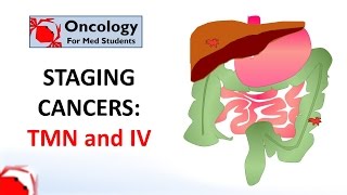 An Approach to GI Bleeding Melena Hematemesis Hematochezia [upl. by Blasius]