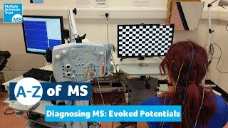 Diagnosing MS  Evoked potentials tests [upl. by Peih194]