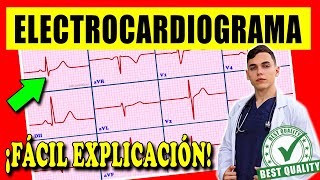 ELECTROCARDIOGRAMA Interpretación [upl. by Sasnak657]