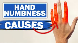 Expert Reveals MindBlowing Facts About Numbness amp Tingling In Fingers [upl. by Harms250]