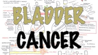 Bladder Cancer  Overview types pathophysiology diagnosis treatment [upl. by Ragnar42]