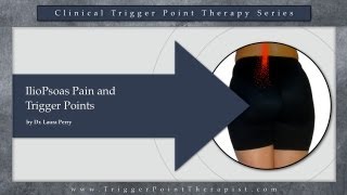 IlioPsoas Pain and Trigger Points [upl. by Cerellia]