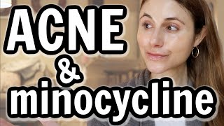 Minocycline versus doxycycline for acne Dr Dray [upl. by Jay898]