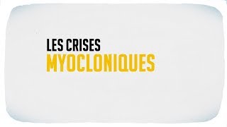 Les crises myocloniques [upl. by Enala]