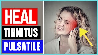 How To Get Rid Of Pulsatile Tinnitus [upl. by Otila770]