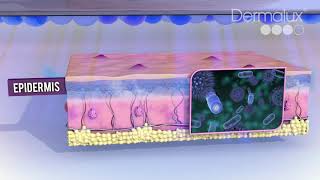 How LED Phototherapy Works [upl. by Inilahs]