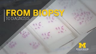 CHEST Foundation  Learn About Lung Biopsies [upl. by Salazar]