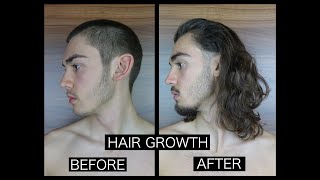 HAIR GROWTH TIME LAPSE  SIDE [upl. by Nerissa]