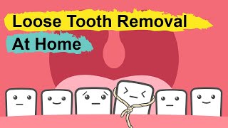 How To Pull Out A Loose Tooth At Home [upl. by Carr690]