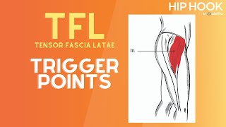 TFL Trigger Point Release  How to Release the Tensor Fascia Latae Muscle [upl. by Press]