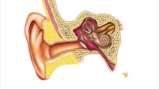 Menieres Disease  WVU Medicine Health Report [upl. by Nylaj]