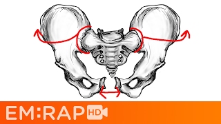 Bad Pelvic Fractures [upl. by Drooff]