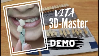 VITA 3DMaster shade guide  How to use [upl. by Avat]