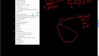 42Hemodynamic DisordersEdemaIncreased Hydrostatic Pressure [upl. by Anabal]