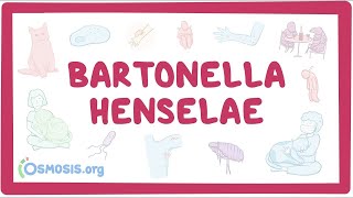 Bartonella henselae  an Osmosis Preview [upl. by Eelnayr]