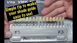 Tooth Shade Selection  Vita Classic [upl. by Laud802]