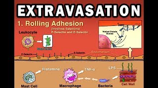 EXTRAVASATION [upl. by Dorison]