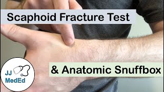 Scaphoid Fracture Test Clinical Exam and the Anatomic Snuffbox [upl. by Elok]