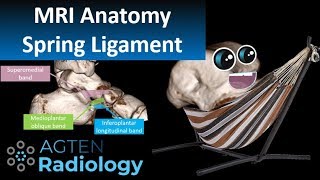 Spring Ligament Complex MRI Anatomy [upl. by Anniken]