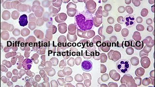 Differential Leucocyte Count DLC Practical Lab [upl. by Inohs379]