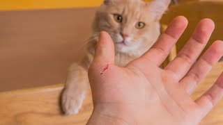 CAT SCRATCH DISEASE  BARTONELLA HENSELAE  Causes Symptoms Treatment Prevention Pathology [upl. by Beitnes]