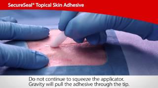 How to use Cyanoacrylate Adhesive [upl. by Paske]