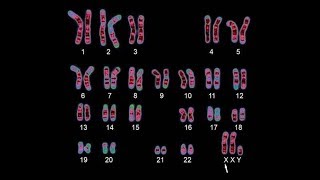 Human Genetics  Karyotyping [upl. by Belter]