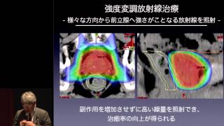 前立腺がんの放射線治療～IMRT、粒子線治療、小線源治療 秋元 哲夫 [upl. by Amikahs]