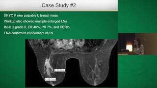 Breast Cancer Surgical Margins [upl. by O'Kelly]