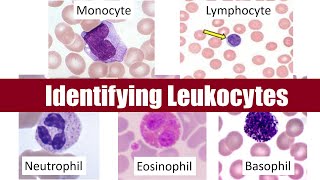 Identifying Leukocytes [upl. by Binnie]