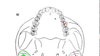 DYNAMIC OCCLUSION  Working vs Nonworking Movement amp Occlusal Grid [upl. by Onailime]